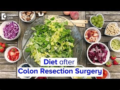 Choose soft, bland foods like mashed potatoes or. . Diet after colon surgery mayo clinic